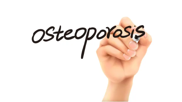 2024 GUIDE TO OSTEOPOROSIS: PREVENTION AND MANAGEMENT